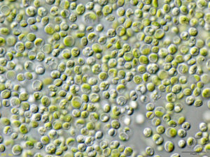 Mikroskopisk bild av chlorella.